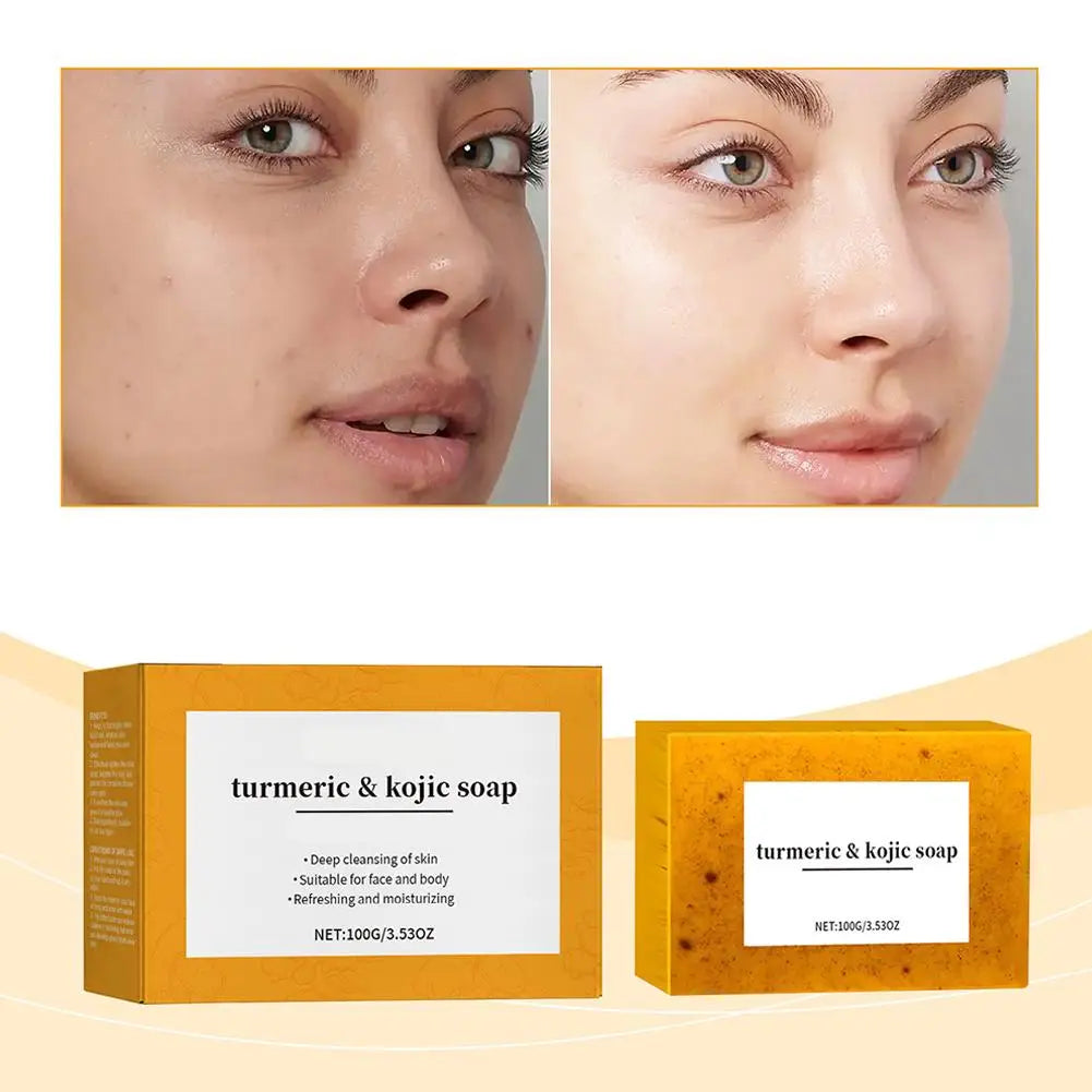 Lemon Turmeric Kojic Acid Soap
